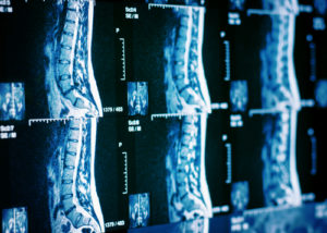 Medical billing expert witness orthopedics spine surgery